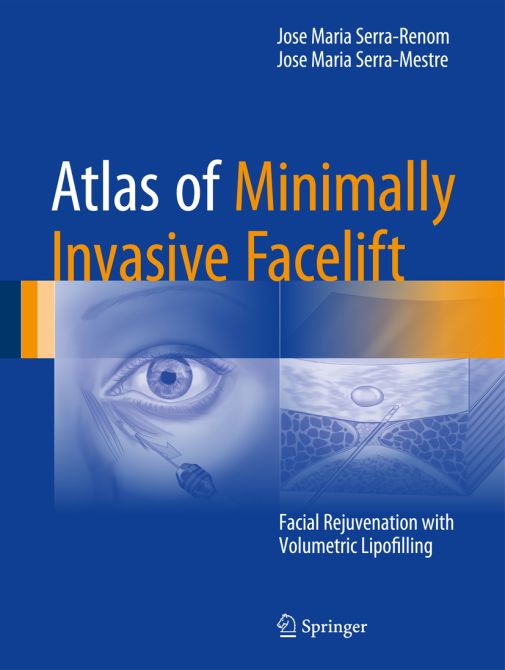 Atlas of Minimally Invasive Facelift