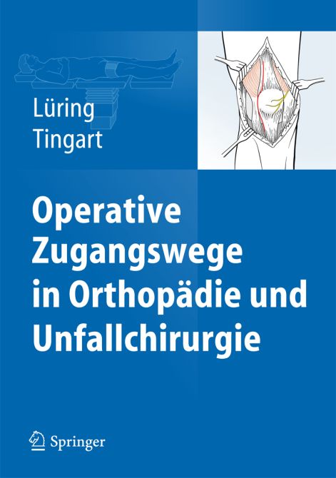 Operative Zugangswege in Orthopädie und Unfallchirurgie