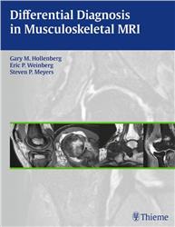 Cover Differential Diagnosis in Musculoskeletal MRI