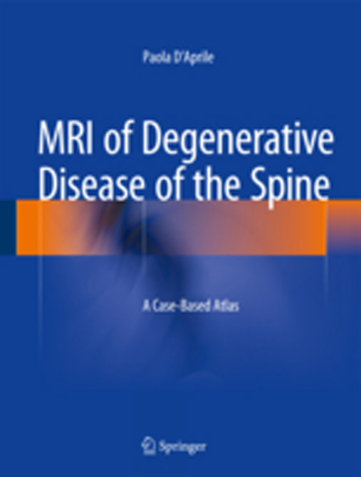 MRI of Degenerative Disease of the Spine