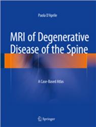 Cover MRI of Degenerative Disease of the Spine