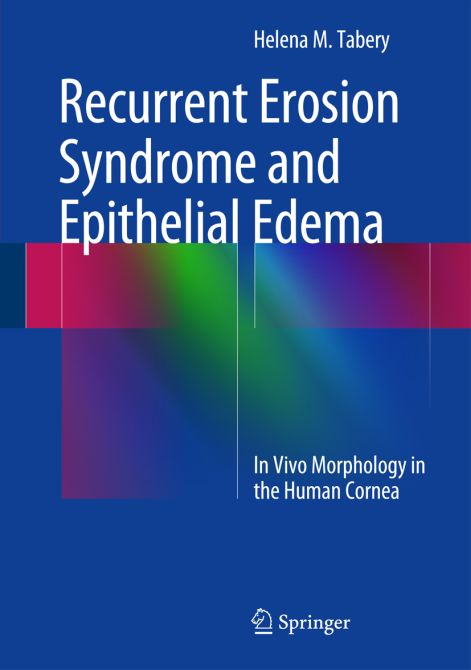 Recurrent Erosion Syndrome and Epithelial Edema