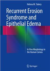 Cover Recurrent Erosion Syndrome and Epithelial Edema