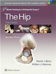 Cover Master Techniques in Orthopaedic Surgery: The Hip