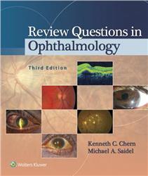 Cover Review Questions in Ophthalmology