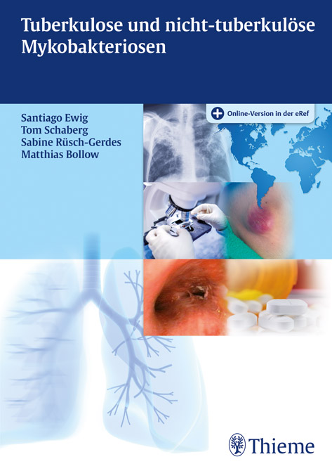 Tuberkulose und nichttuberkulöse Mykobakteriosen
