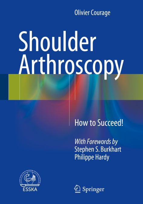 Shoulder Arthroscopy