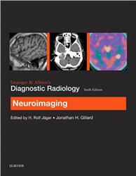 Cover Grainger & Allison’s Diagnostic Radiology: Neuroimaging