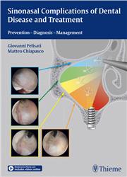 Cover Sinonasal Complications of Dental Disease and Treatment