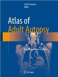 Cover Atlas of Adult Autopsy