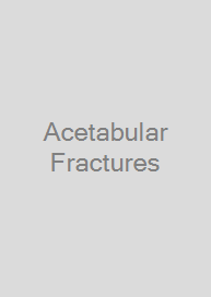 Cover Acetabular Fractures