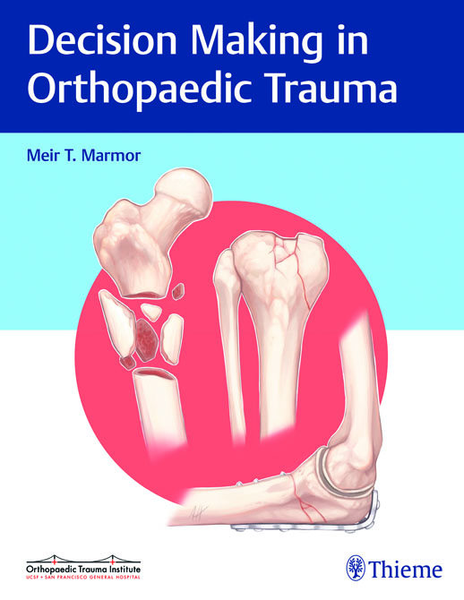 Decision Making in Orthopaedic Trauma