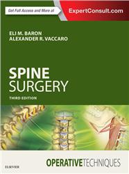Cover Operative Techniques: Spine Surgery