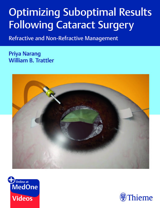 Optimizing Suboptimal Results Following Cataract Surgery