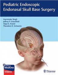 Cover Pediatric Endoscopic Endonasal Skull Base Surgery