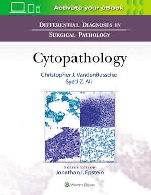 Differential Diagnoses in Surgical Pathology: Cytopathology 1e