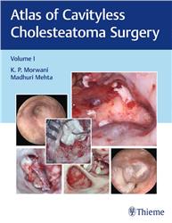 Cover Atlas of Cavityless Cholesteatoma Surgery, Vol 1