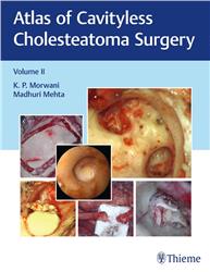 Cover Atlas of Cavityless Cholesteatoma Surgery, Vol 2