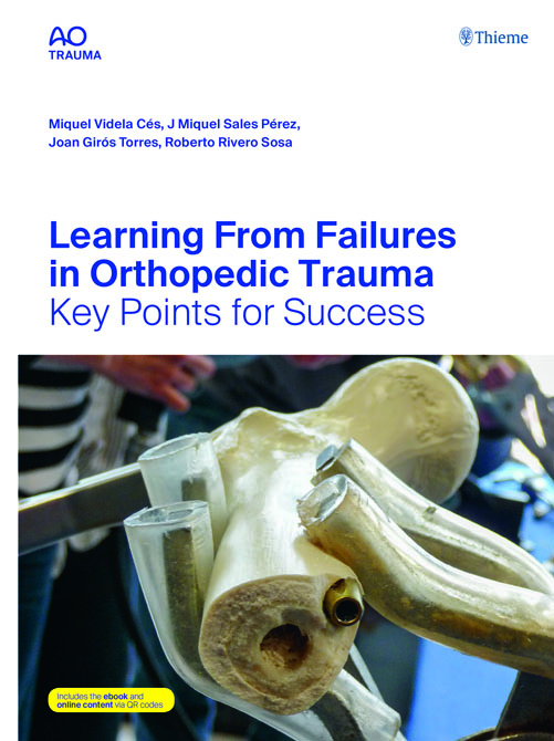 AO Learning from Failures in Orthopedic Trauma