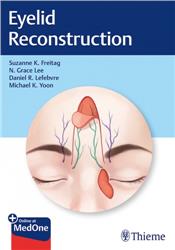 Cover Eyelid Reconstruction