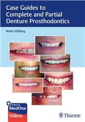 Cover Case Guides to Complete and Partial Denture Prosthodontics