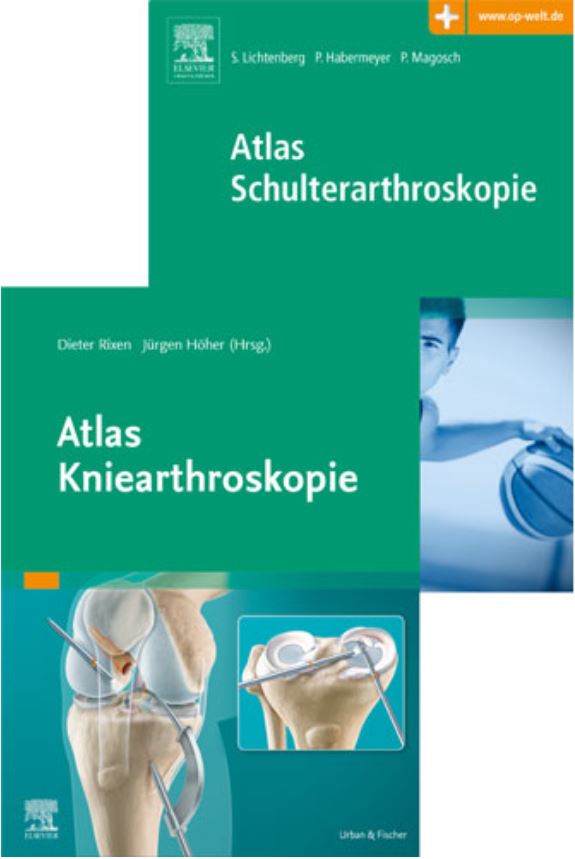 Arthroskopie-Set Knie/Schulter