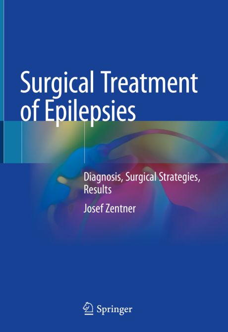 Surgical Treatment of Epilepsies