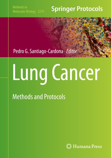 Lung Cancer: Methods and Protocols