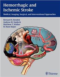 Cover Hemorrhagic and Ischemic Stroke