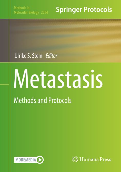 Metastasis: Methods and Protocols