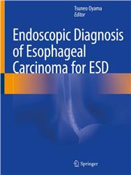 Cover Endoscopic Diagnosis of Esophageal Carcinoma for ESD