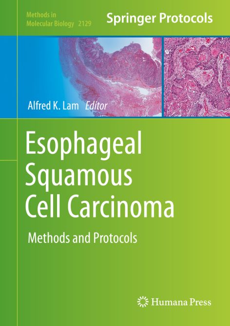 Esophageal Squamous Cell Carcinoma