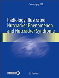 Cover Radiology Illustrated: Nutcracker Phenomenon and Nutcracker Syndrome