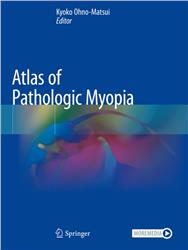 Cover Atlas of Pathologic Myopia