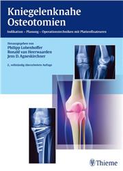Cover Kniegelenknahe Osteotomien