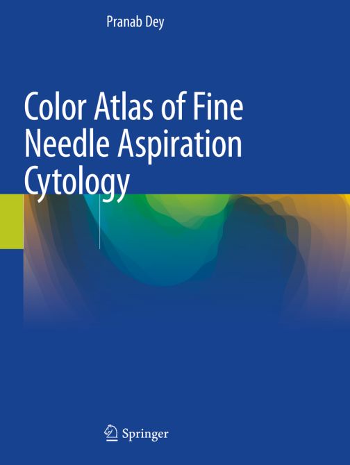 Color Atlas of Fine Needle Aspiration Cytology