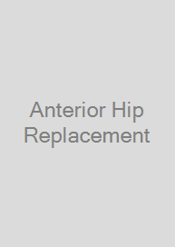 Anterior Hip Replacement