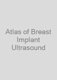 Atlas of Breast Implant Ultrasound