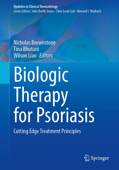 Biologic Therapy for Psoriasis