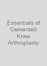 Essentials of Cemented Knee Arthroplasty