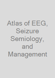 Cover Atlas of EEG, Seizure Semiology, and Management