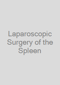 Cover Laparoscopic Surgery of the Spleen