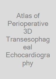 Atlas of Perioperative 3D Transesophageal Echocardiography