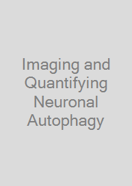 Cover Imaging and Quantifying Neuronal Autophagy