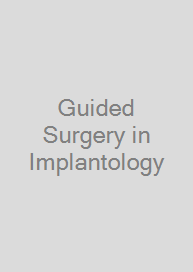 Guided Surgery in Implantology