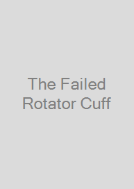 Cover The Failed Rotator Cuff