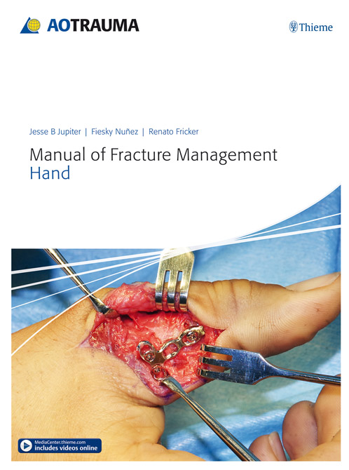 AO Trauma Manual of Fracture Management - Hand
