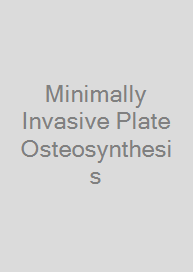 Cover Minimally Invasive Plate Osteosynthesis
