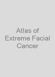 Cover Atlas of Extreme Facial  Cancer