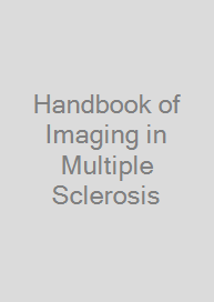 Cover Handbook of Imaging in Multiple Sclerosis